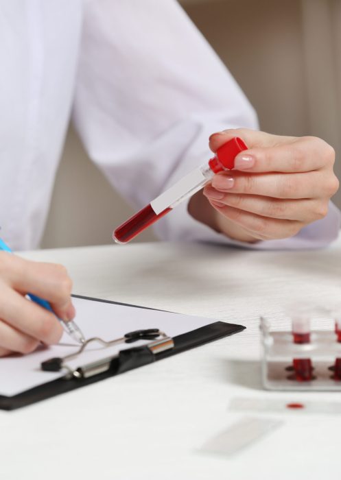Woman working with blood samples in laboratory, closeup